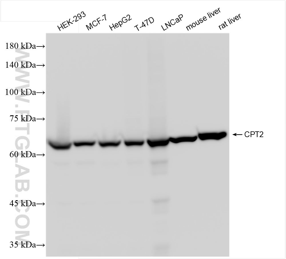 WB analysis using 85013-4-RR (same clone as 85013-4-PBS)