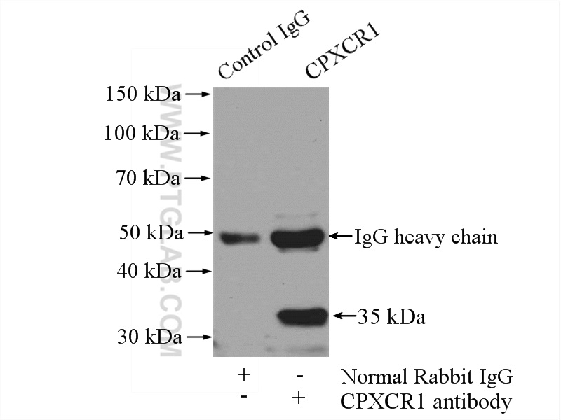 IP experiment of mouse skeletal muscle using 26005-1-AP