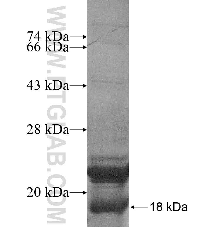 CPXM2 fusion protein Ag16626 SDS-PAGE CPXM2 fusion protein Ag16626 SDS-PAGE