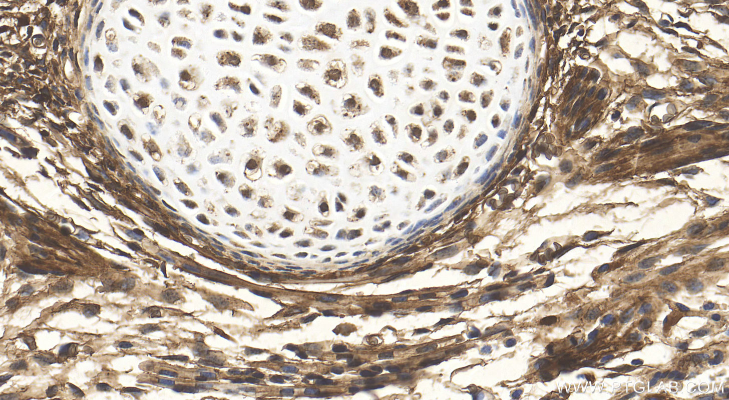 IHC staining of mouse embryo using 10225-1-AP