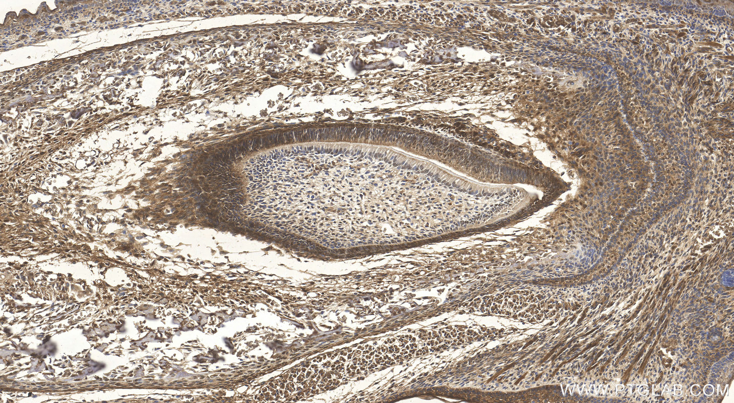 IHC staining of mouse embryo using 10225-1-AP
