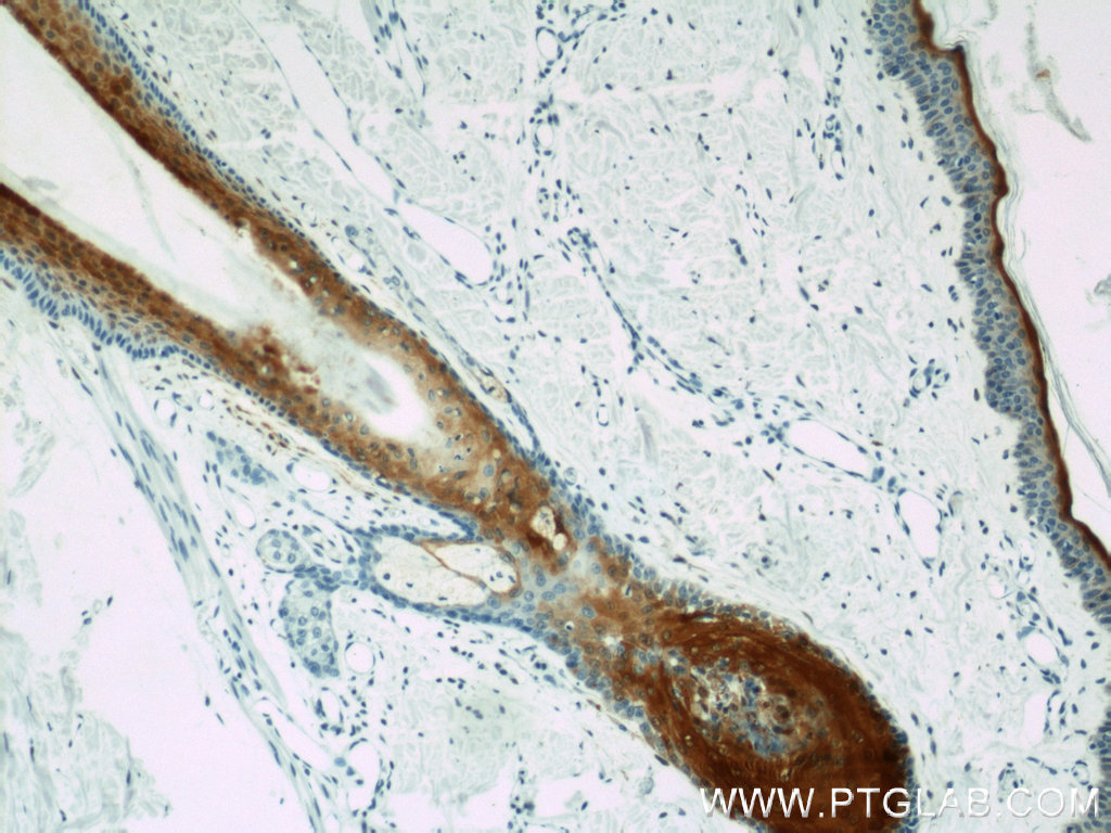 IHC staining of human skin using 10225-1-AP