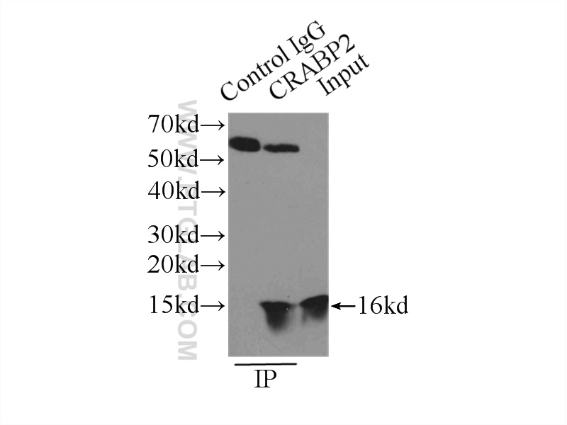 IP experiment of HeLa using 10225-1-AP