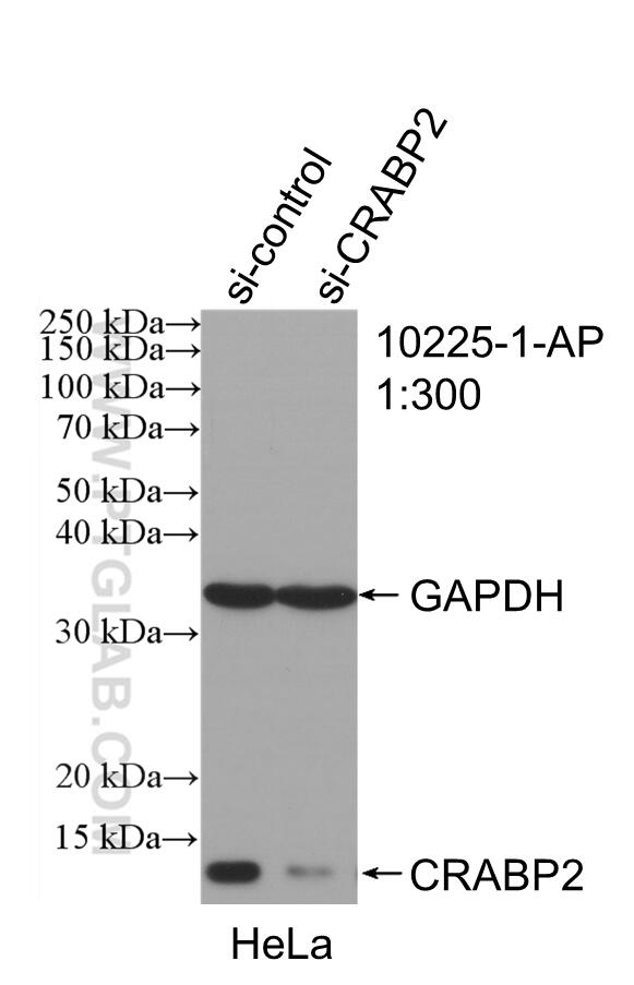 WB analysis of HeLa using 10225-1-AP