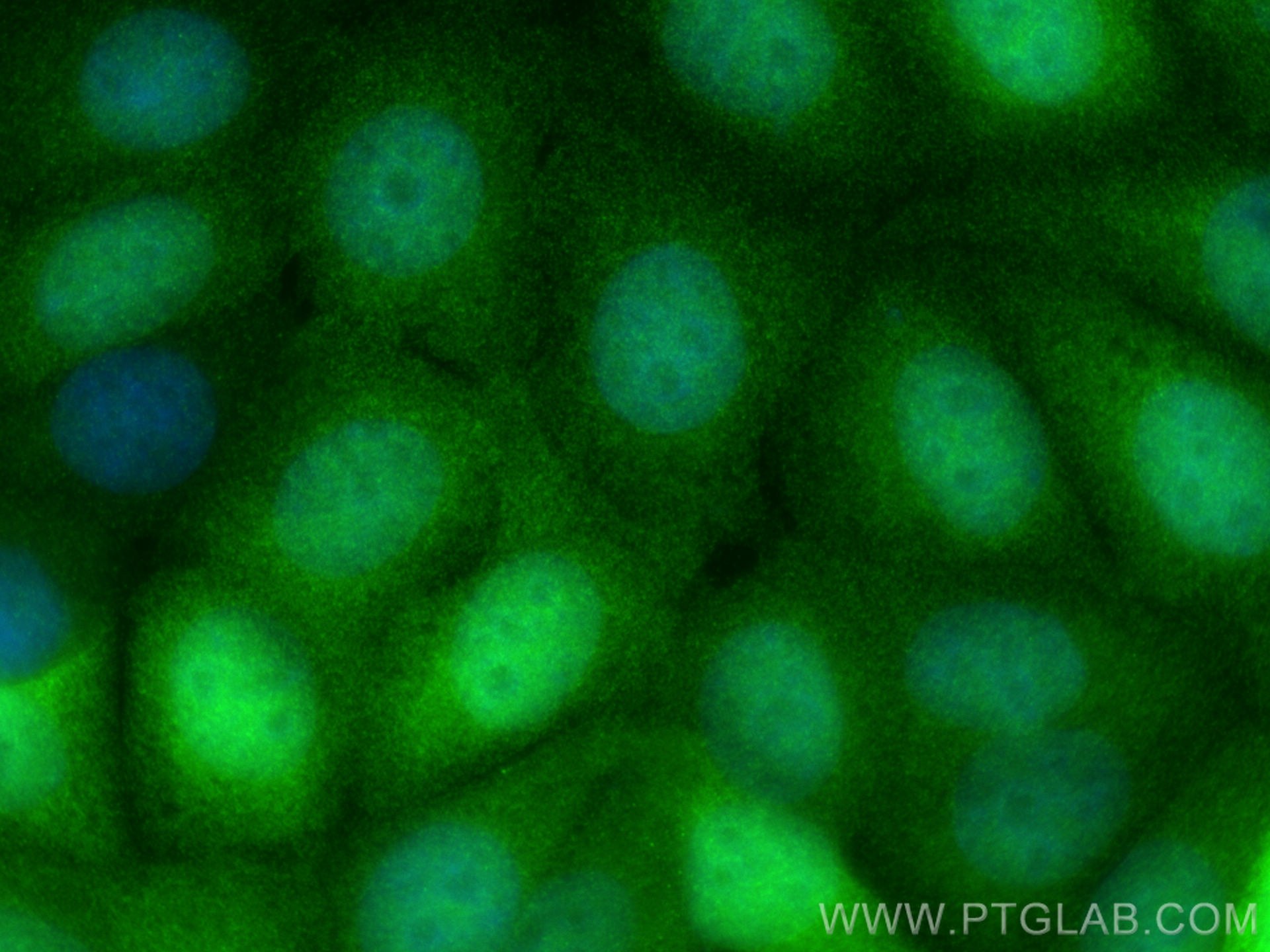 IF Staining of MCF-7 using 66468-1-Ig