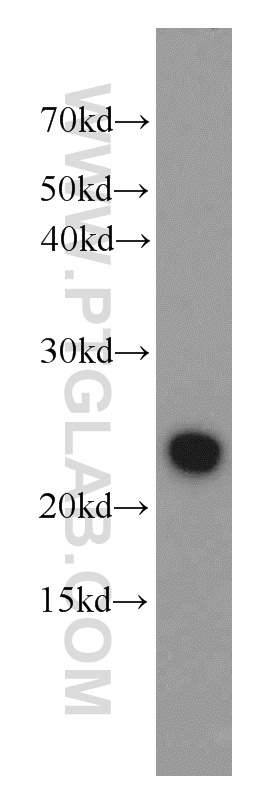 WB analysis of K-562 using 10401-1-AP