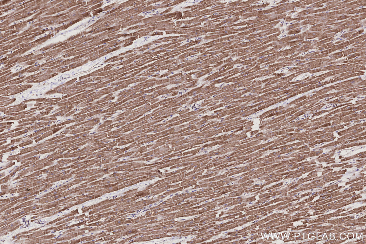IHC staining of human heart using 15170-1-AP IHC staining of human heart using 15170-1-AP