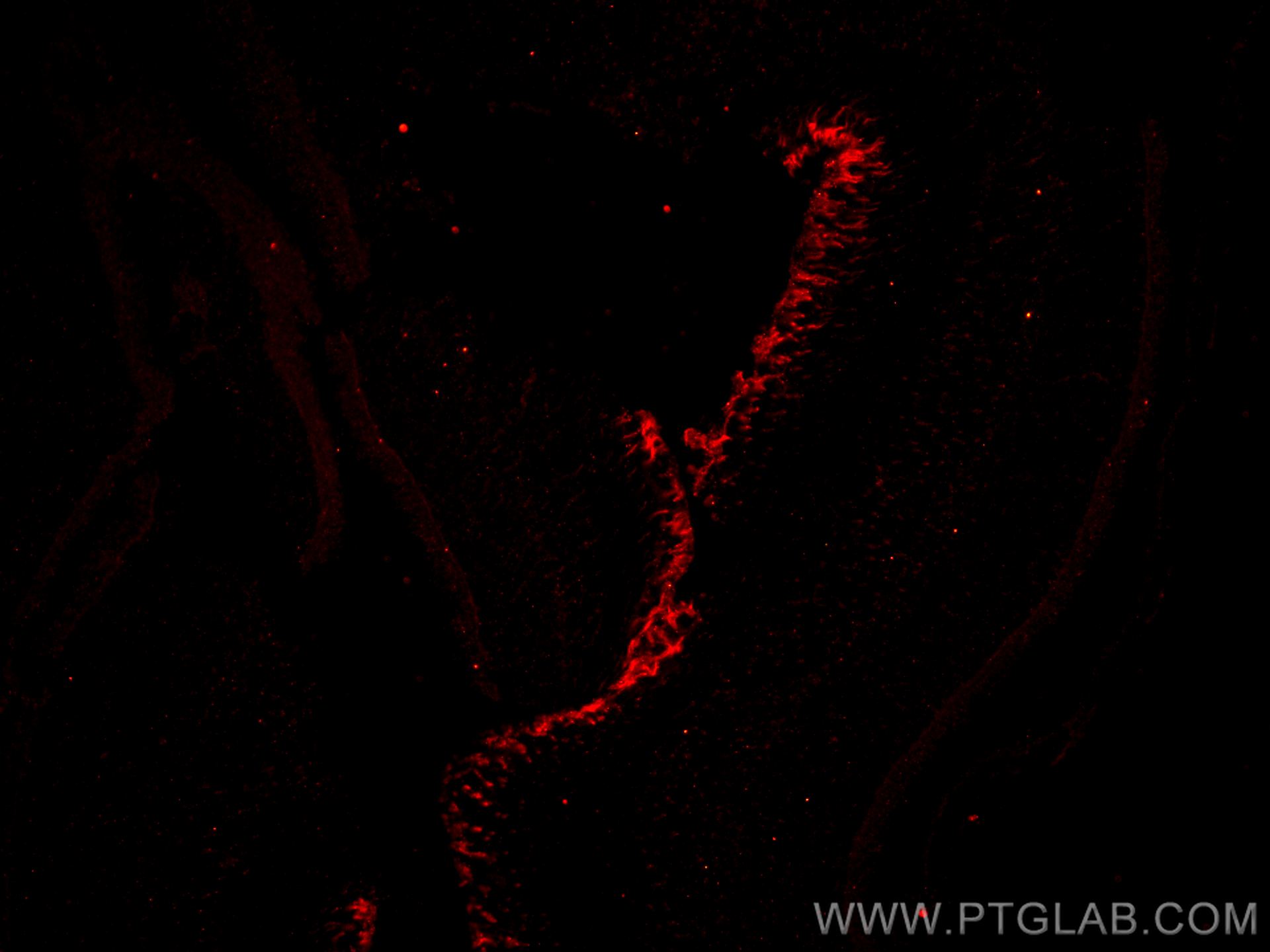 IF Staining of mouse eye using 26598-1-AP