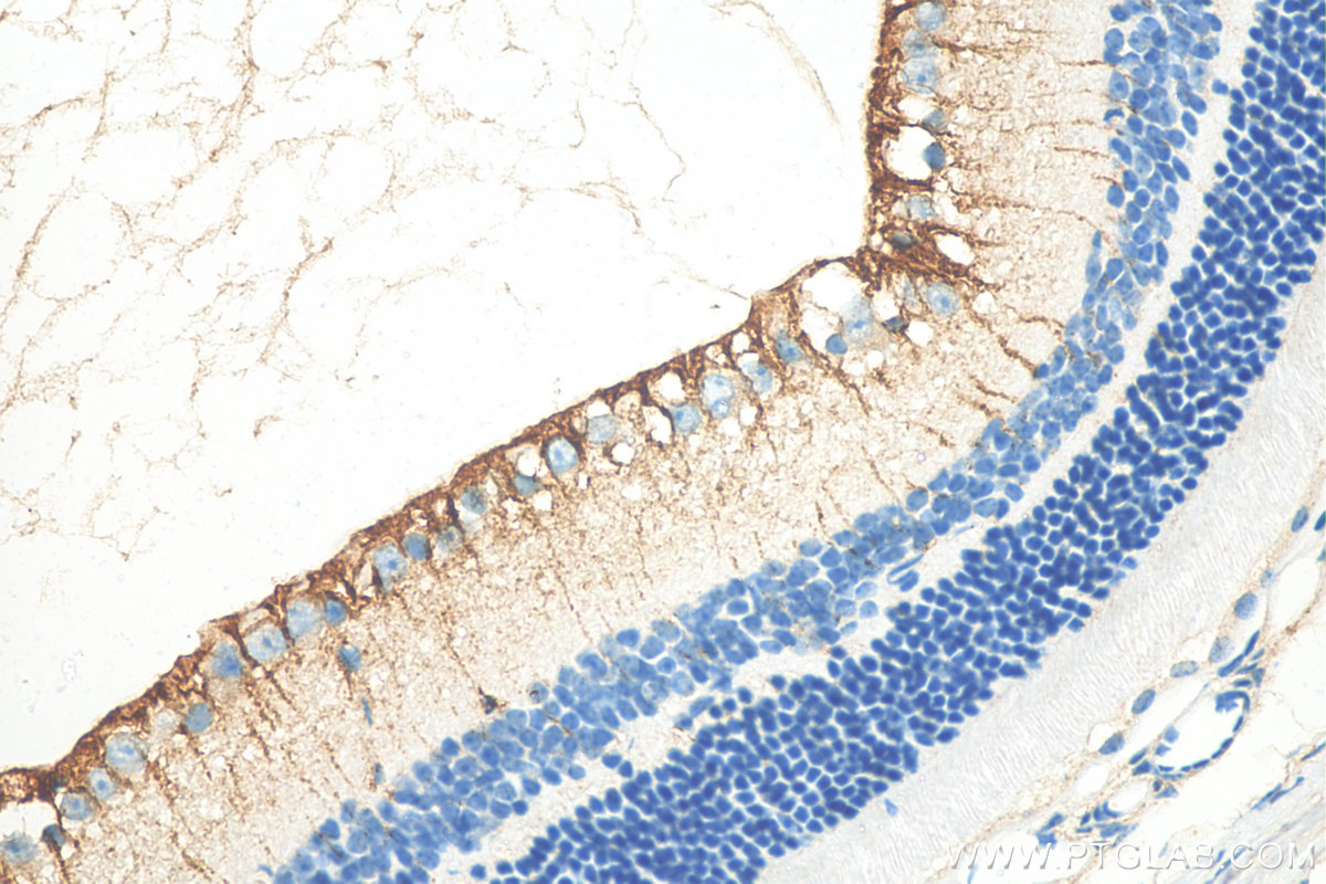 IHC staining of mouse eye using 26598-1-AP