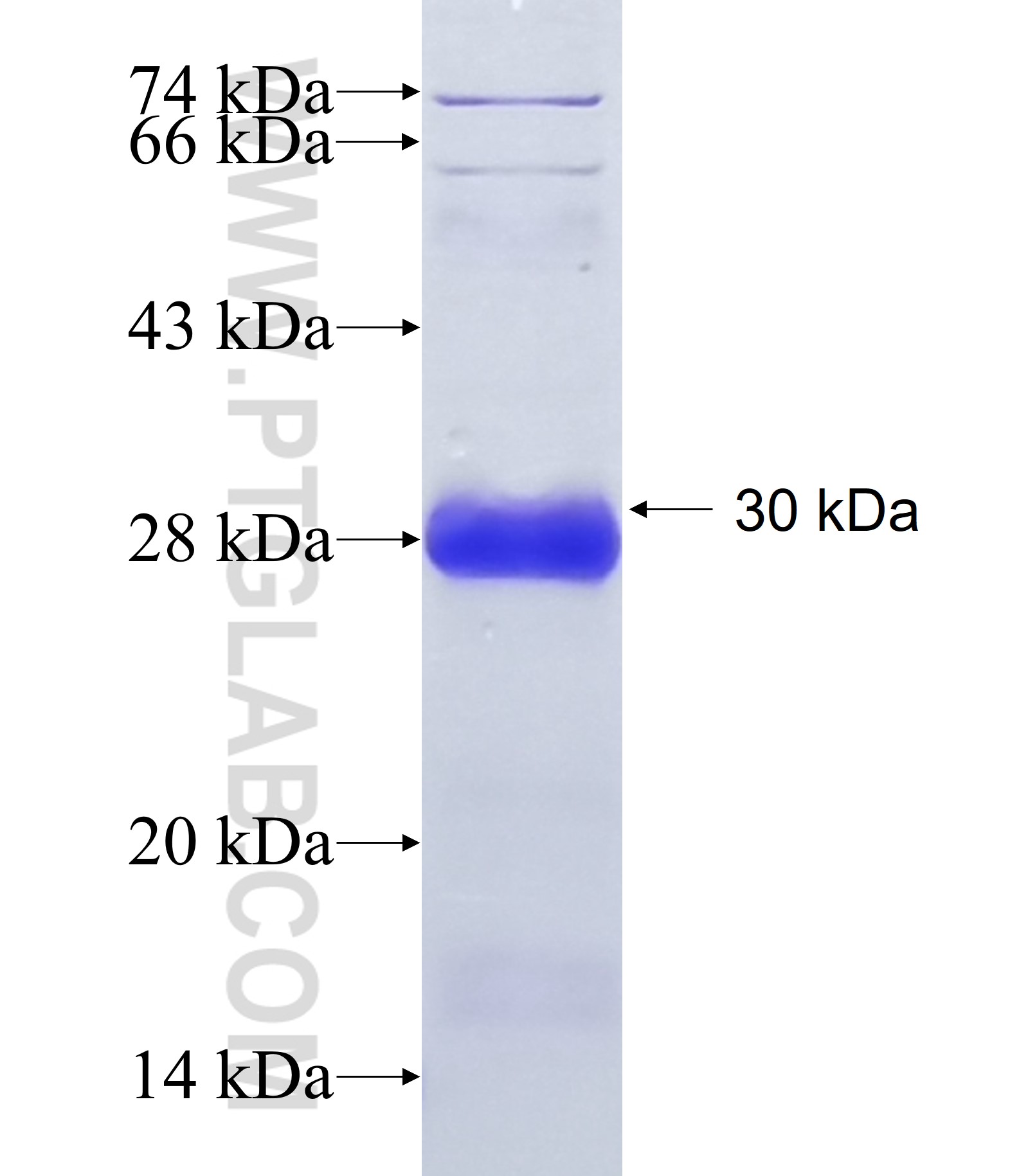 CRB1 fusion protein Ag24139 SDS-PAGE CRB1 fusion protein Ag24139 SDS-PAGE