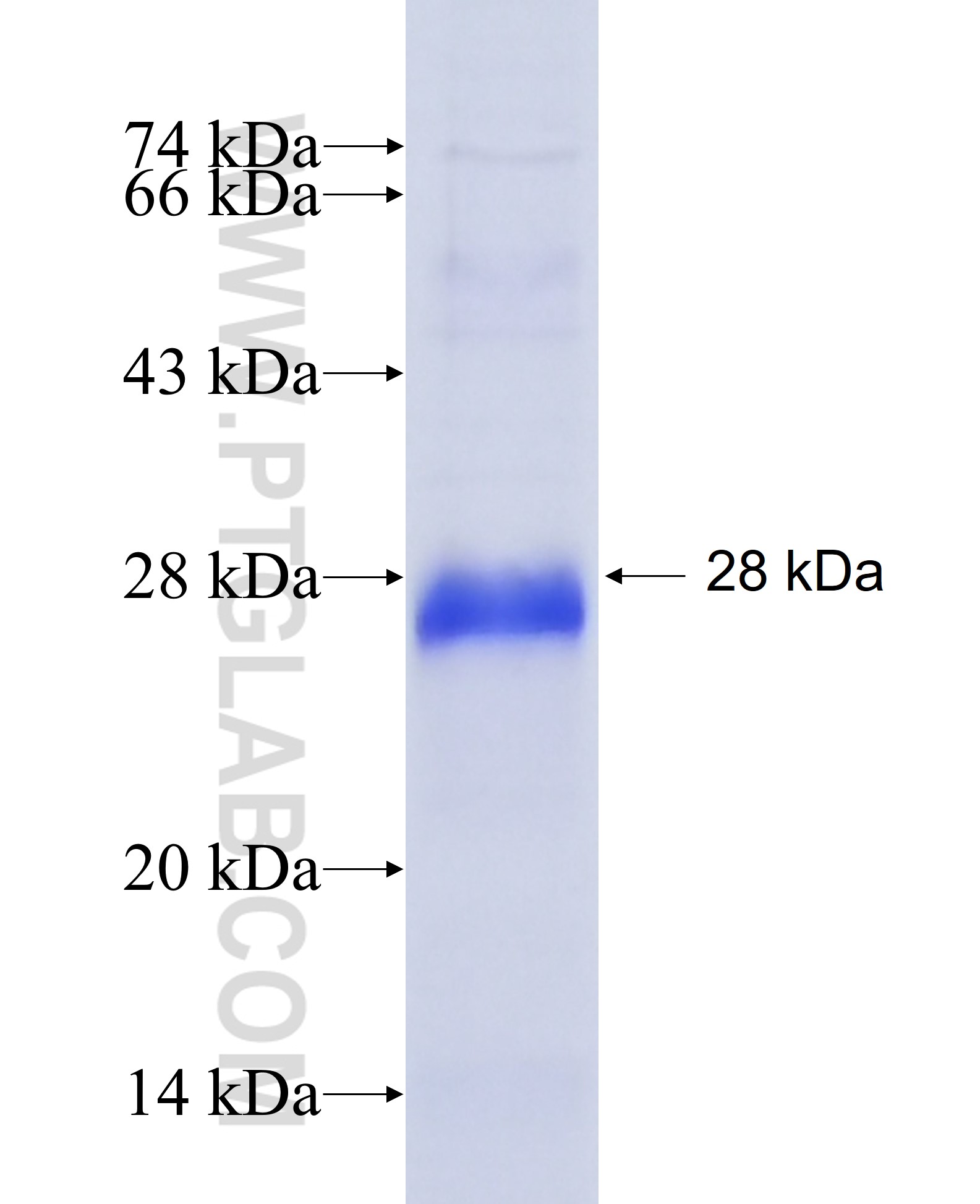 CRB2 fusion protein Ag27774 SDS-PAGE CRB2 fusion protein Ag27774 SDS-PAGE