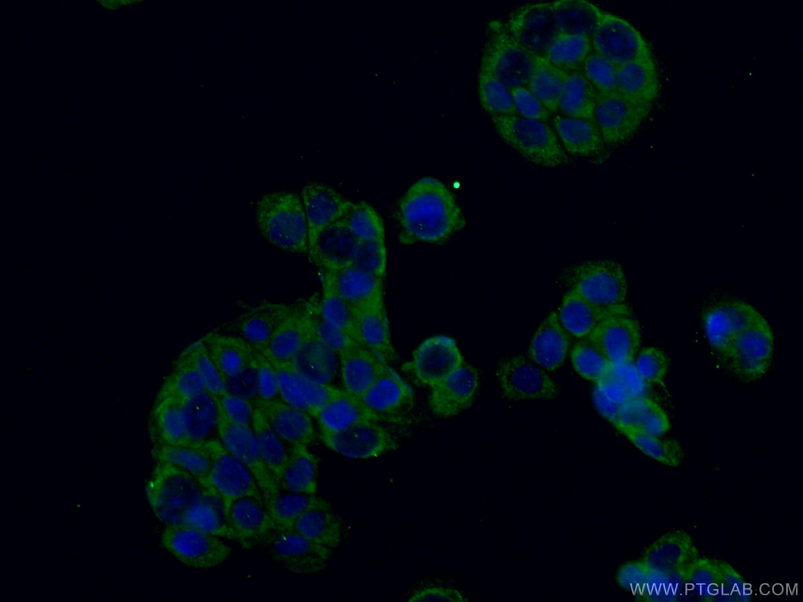 IF Staining of COLO 320 using 11435-1-AP