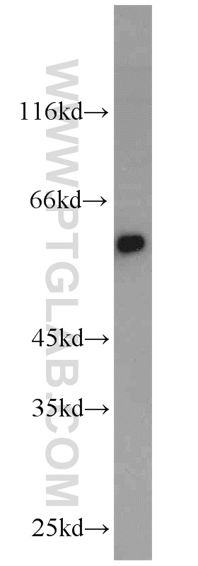 WB analysis of mouse heart using 11435-1-AP