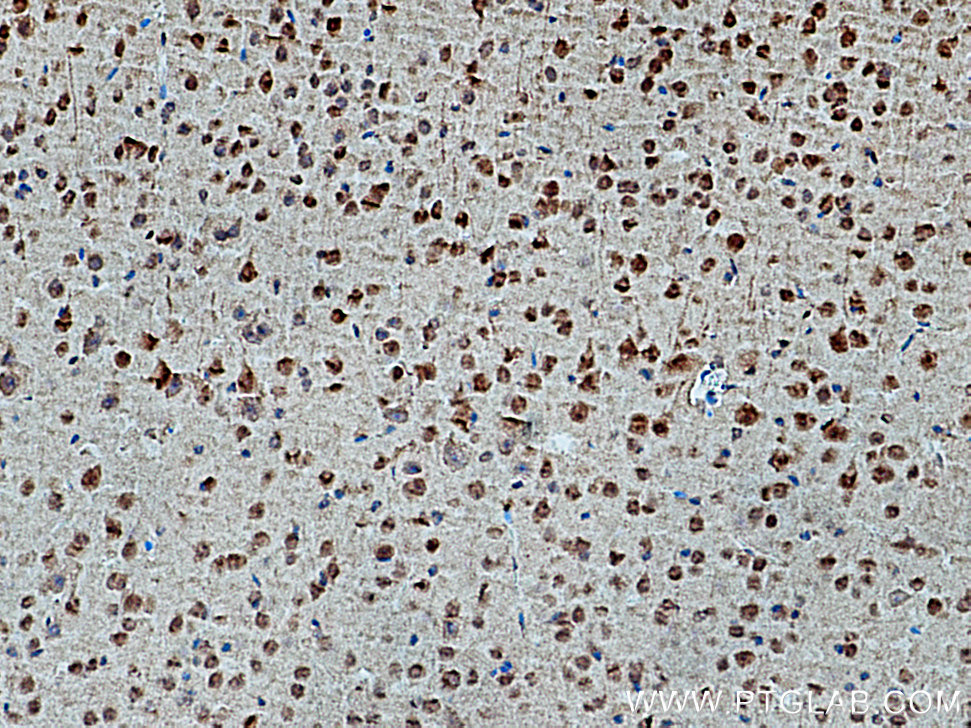 IHC staining of mouse brain using 28494-1-AP