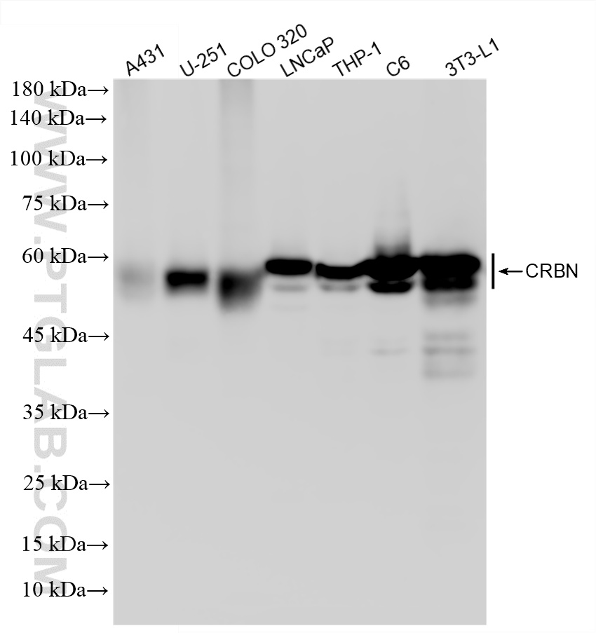 WB analysis using 87559-1-RR (same clone as 87559-1-PBS) WB analysis using 87559-1-RR (same clone as 87559-1-PBS)