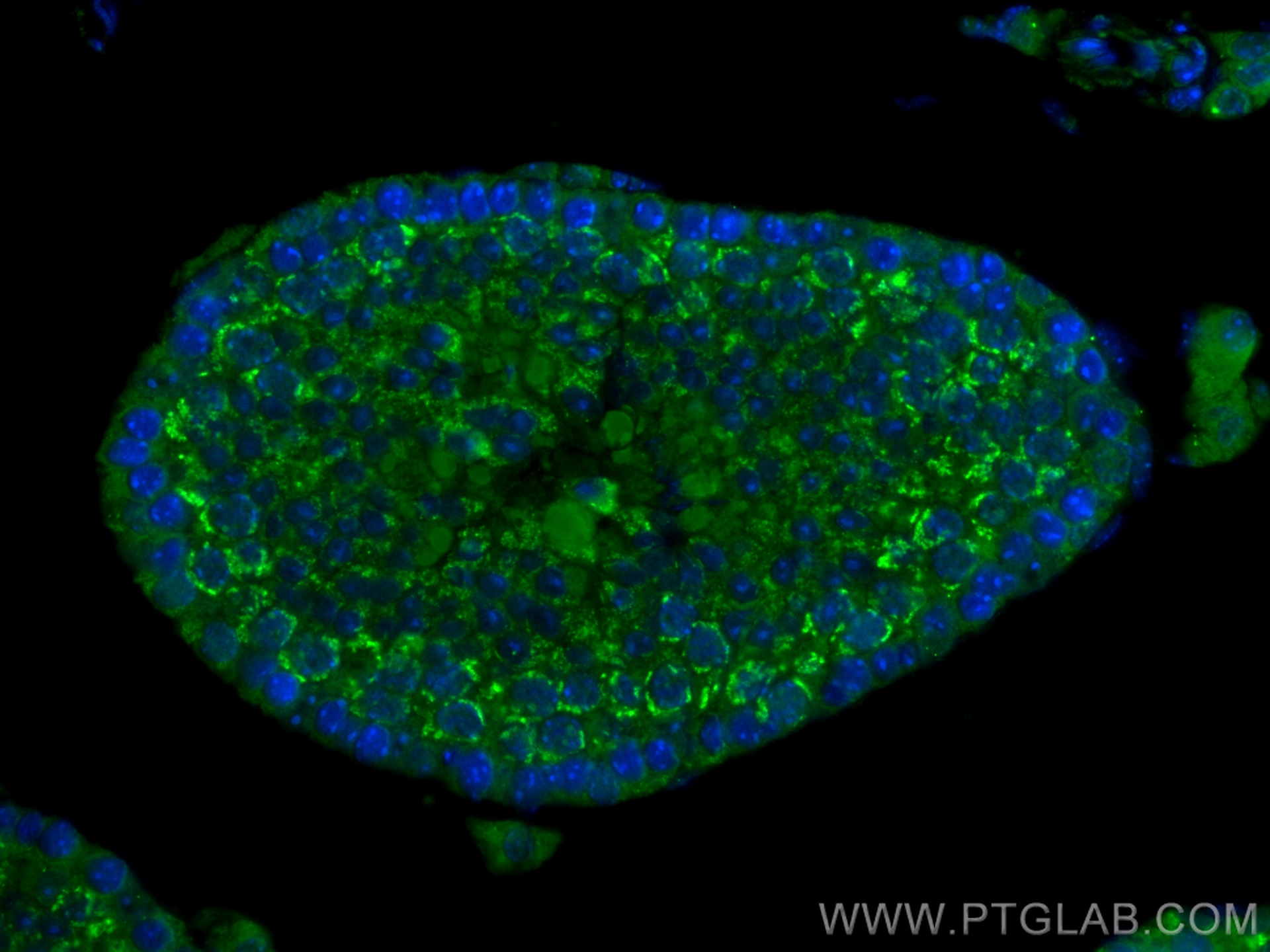 IF Staining of mouse testis using 14348-1-AP
