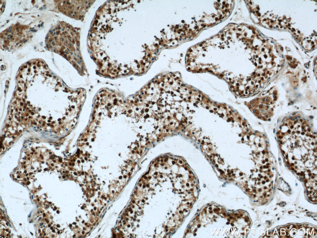 IHC staining of human testis using 14348-1-AP