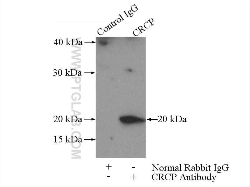 IP experiment of Raji using 14348-1-AP