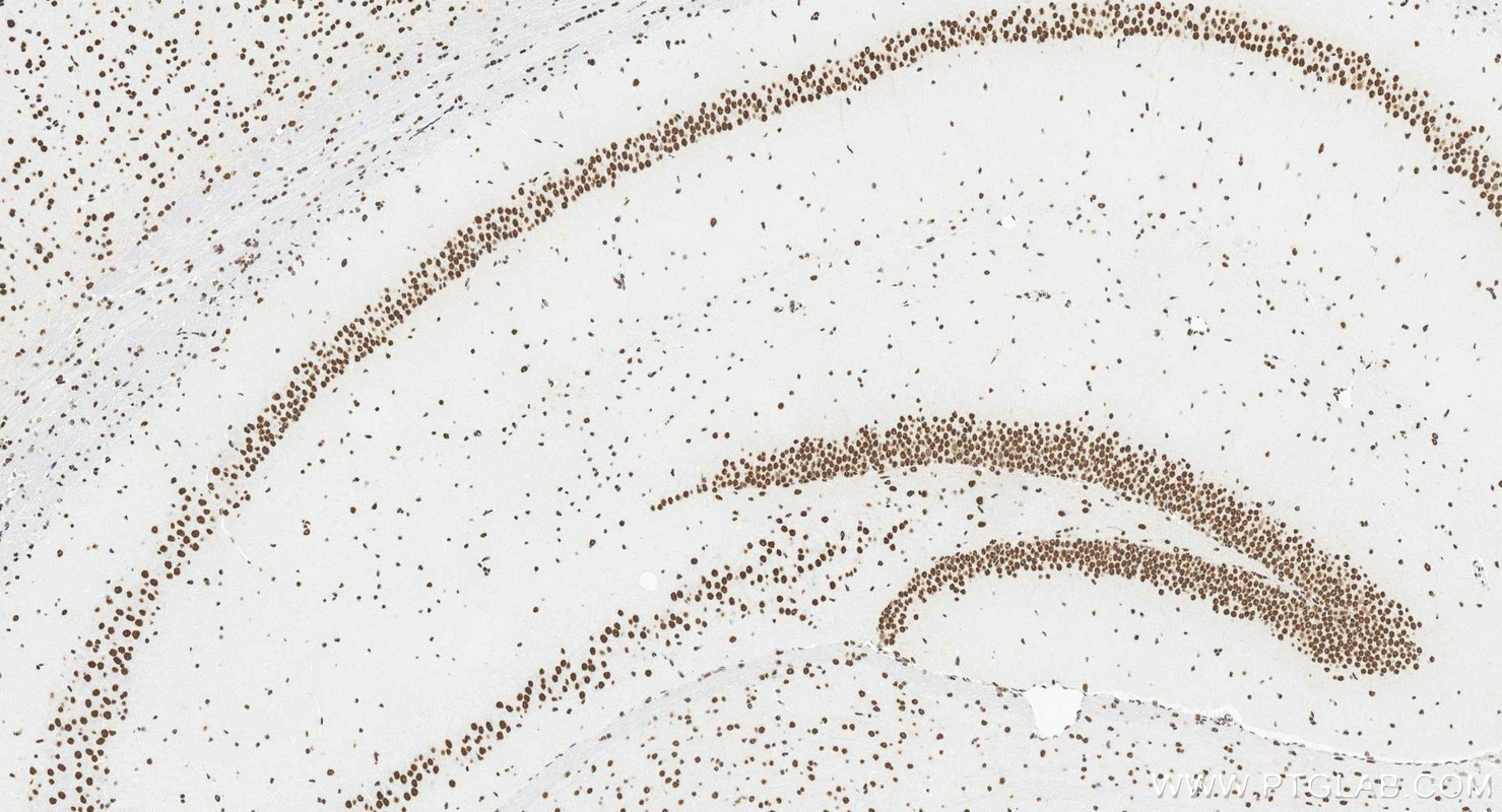 IHC staining of mouse brain using 88035-1-RR (same clone as 88035-1-PBS) IHC staining of mouse brain using 88035-1-RR (same clone as 88035-1-PBS)