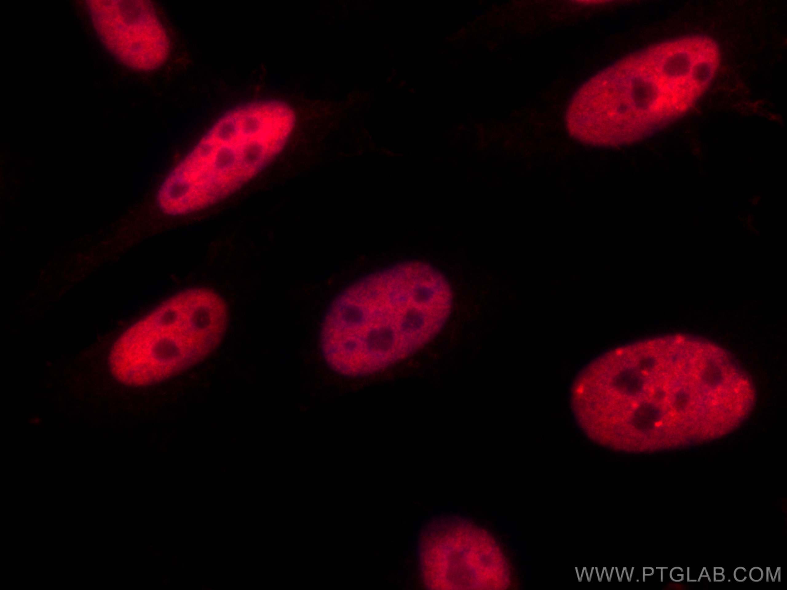 IF Staining of HeLa using CL594-12208