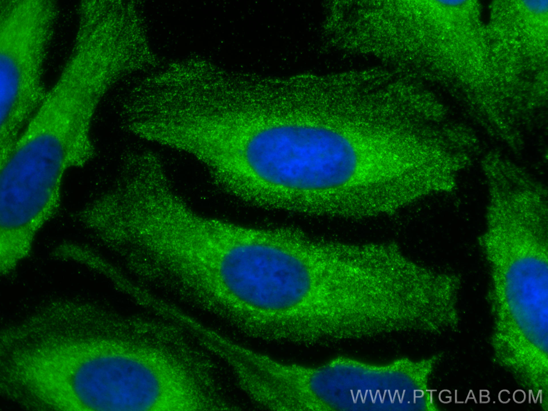 IF Staining of U2OS using 11275-1-AP