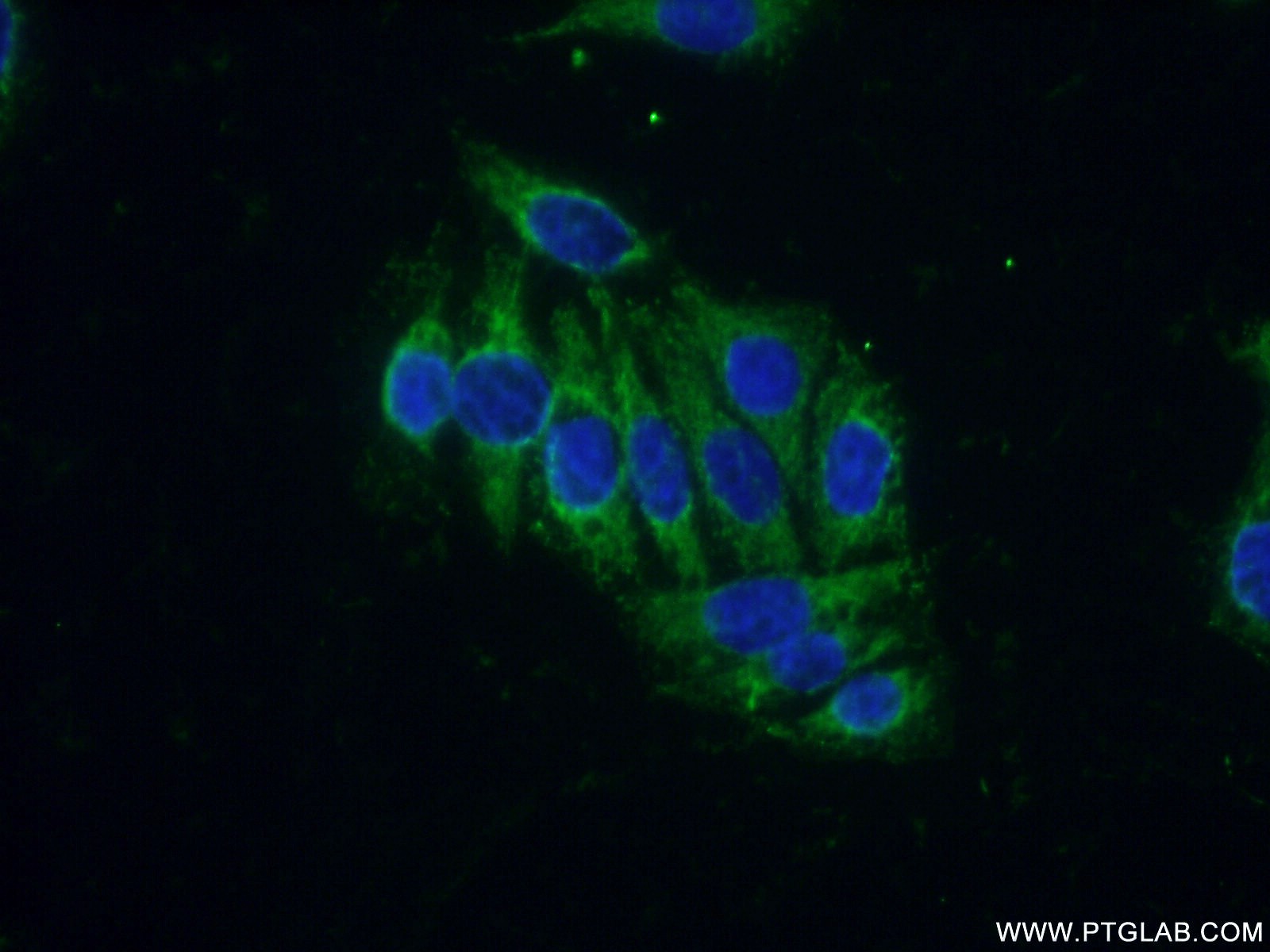 IF Staining of PC-3 using 11275-1-AP