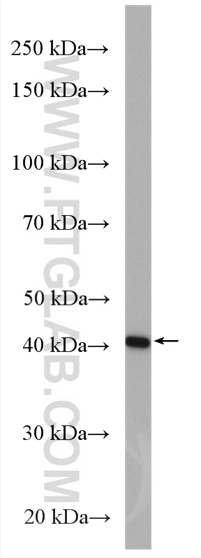 WB analysis of Jurkat using 11275-1-AP