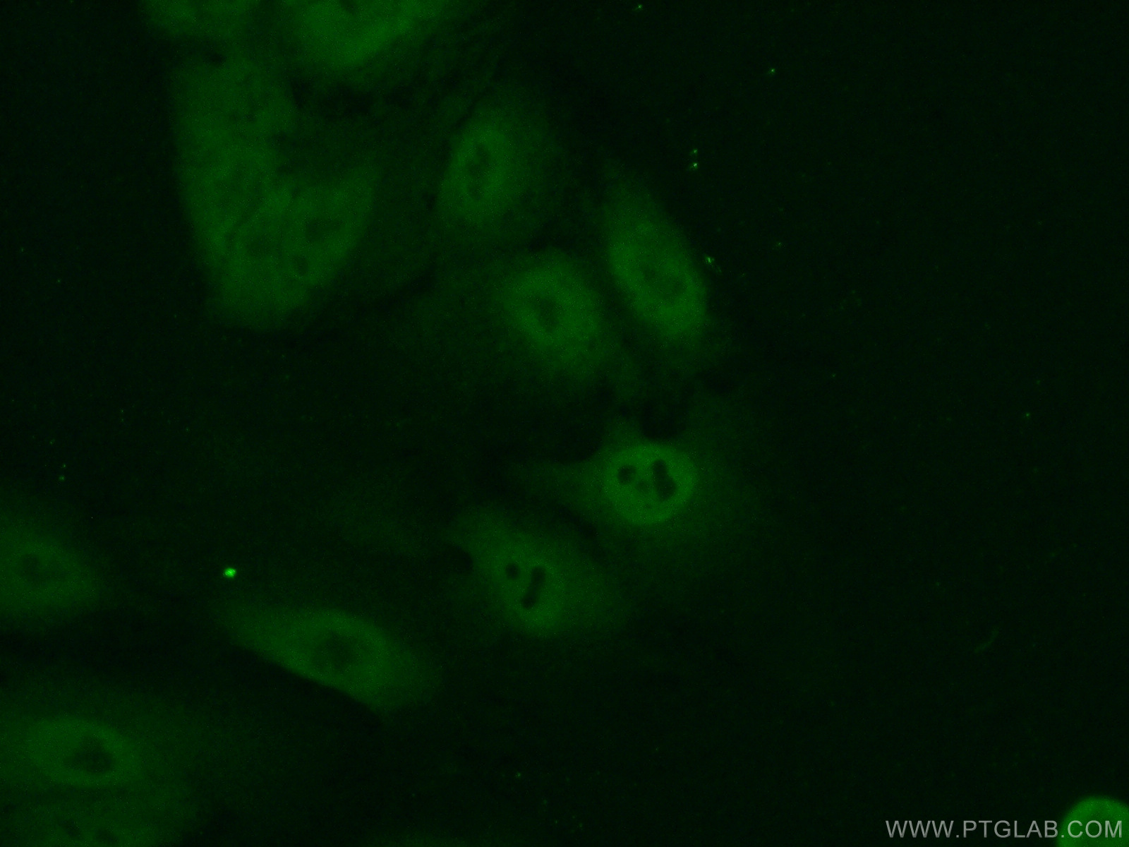 IF Staining of A549 using 11235-2-AP