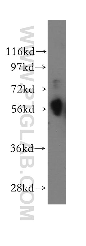 WB analysis of A549 using 11235-2-AP