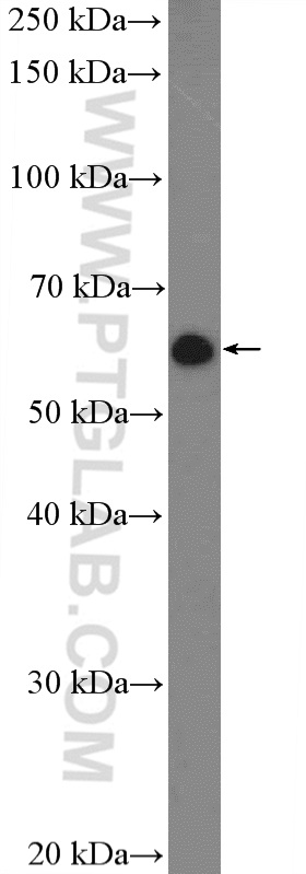 CREB3L2 Polyclonal antibody
