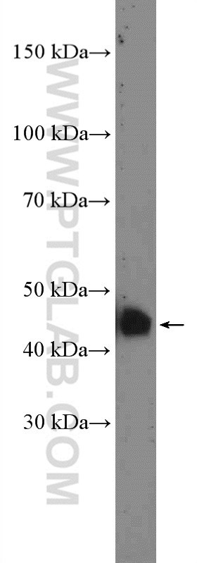 WB analysis of human placenta using 27017-1-AP