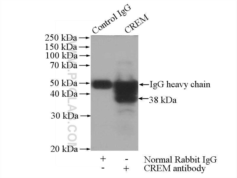 IP experiment of mouse testis using 12131-1-AP