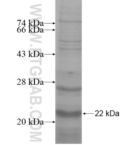 CREM fusion protein Ag14486 SDS-PAGE CREM fusion protein Ag14486 SDS-PAGE