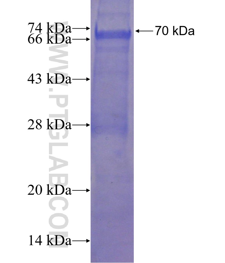 CREST fusion protein Ag3119 SDS-PAGE