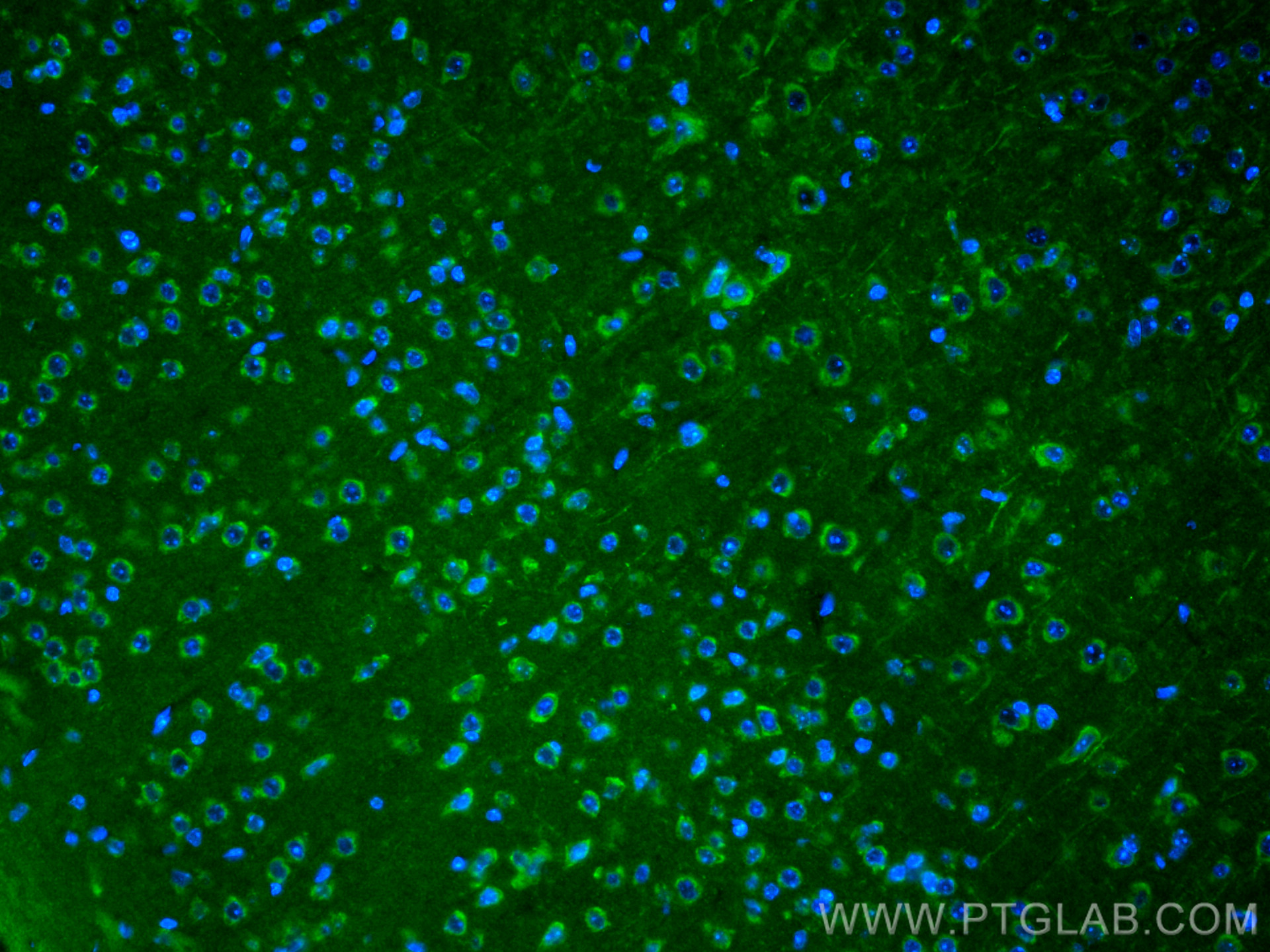 IF Staining of mouse brain using 10944-1-AP