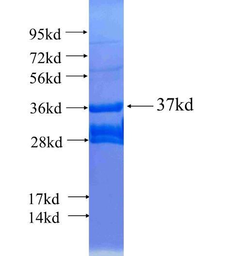 CRH fusion protein Ag25226 SDS-PAGE