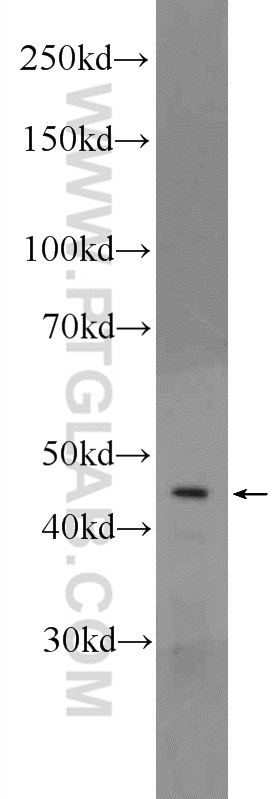 CRHR1 Polyclonal antibody