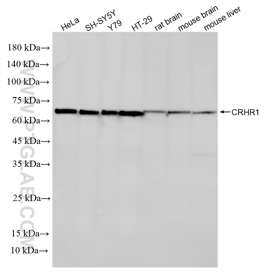 WB analysis using 87114-1-RR (same clone as 87114-1-PBS)