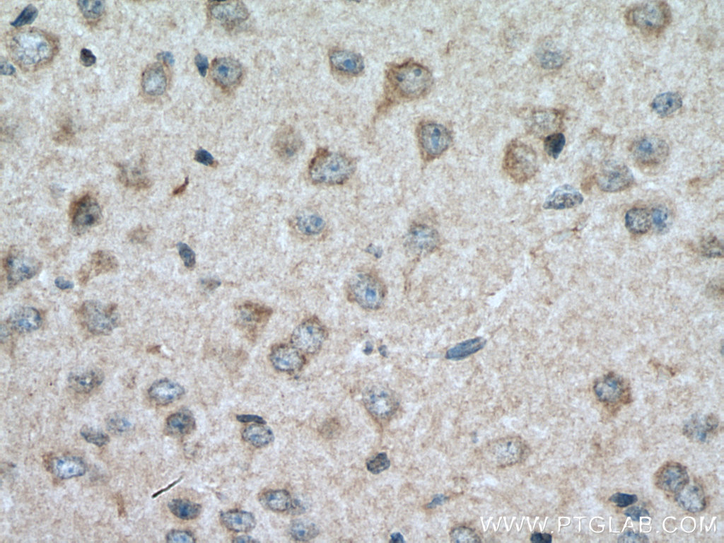 IHC staining of mouse brain using 25267-1-AP