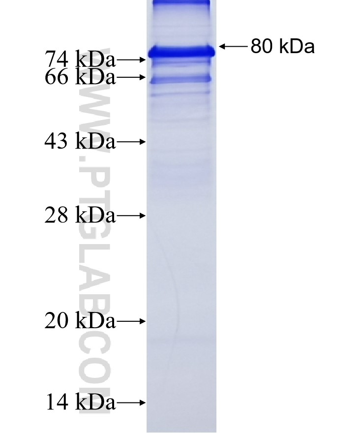CRIM1 fusion protein Ag16349 SDS-PAGE CRIM1 fusion protein Ag16349 SDS-PAGE