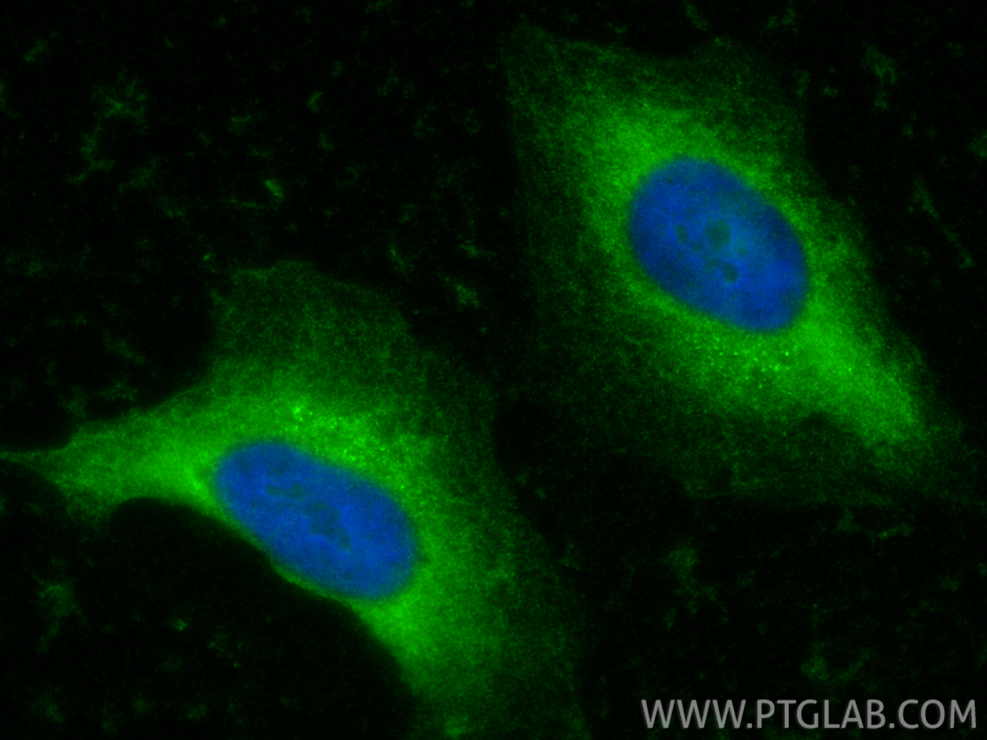 IF Staining of HeLa using 15349-1-AP