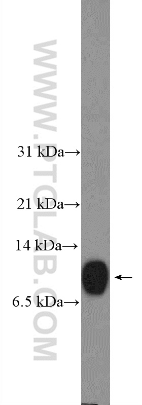 WB analysis of HeLa using 15349-1-AP