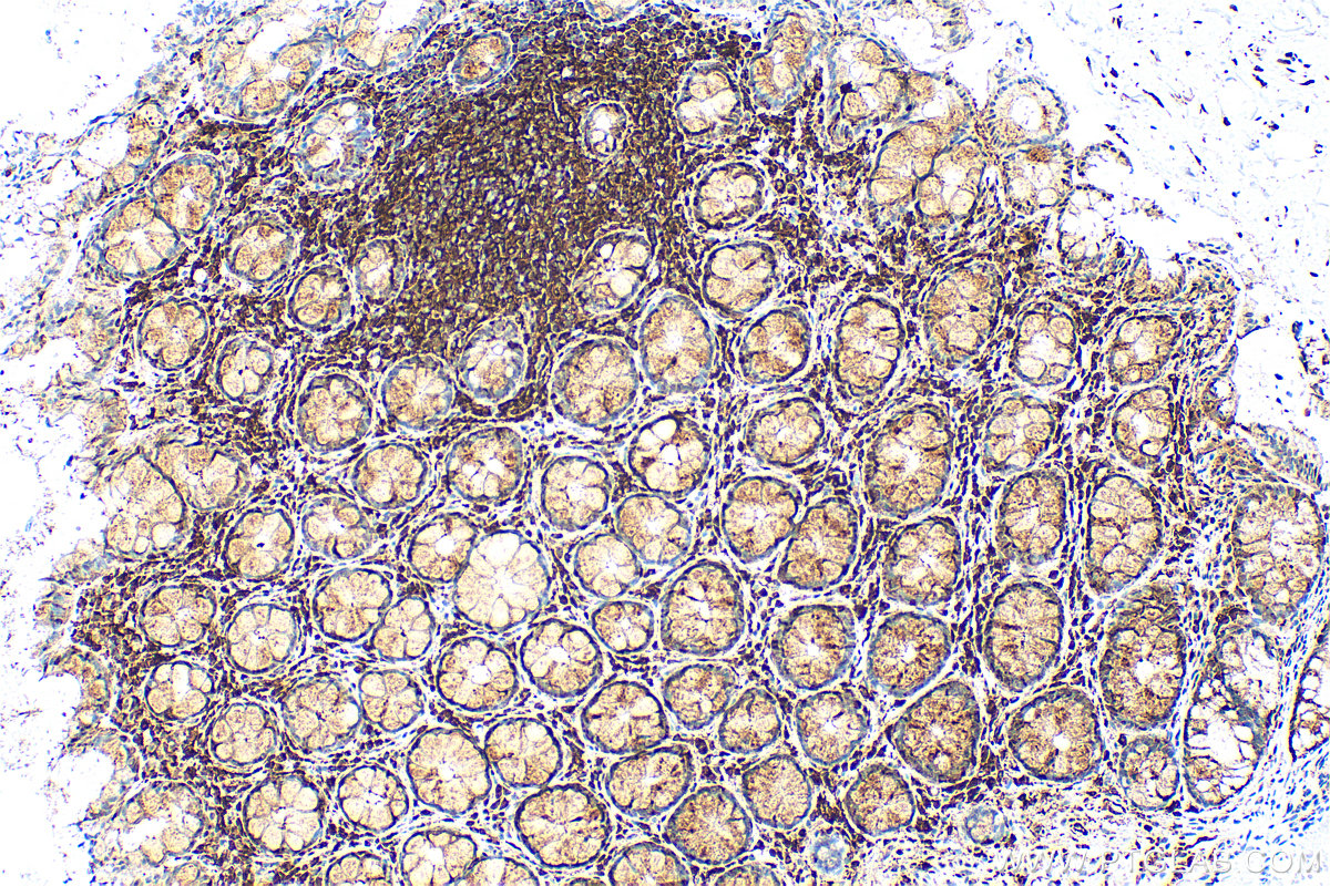 IHC staining of human colon using 83340-3-RR