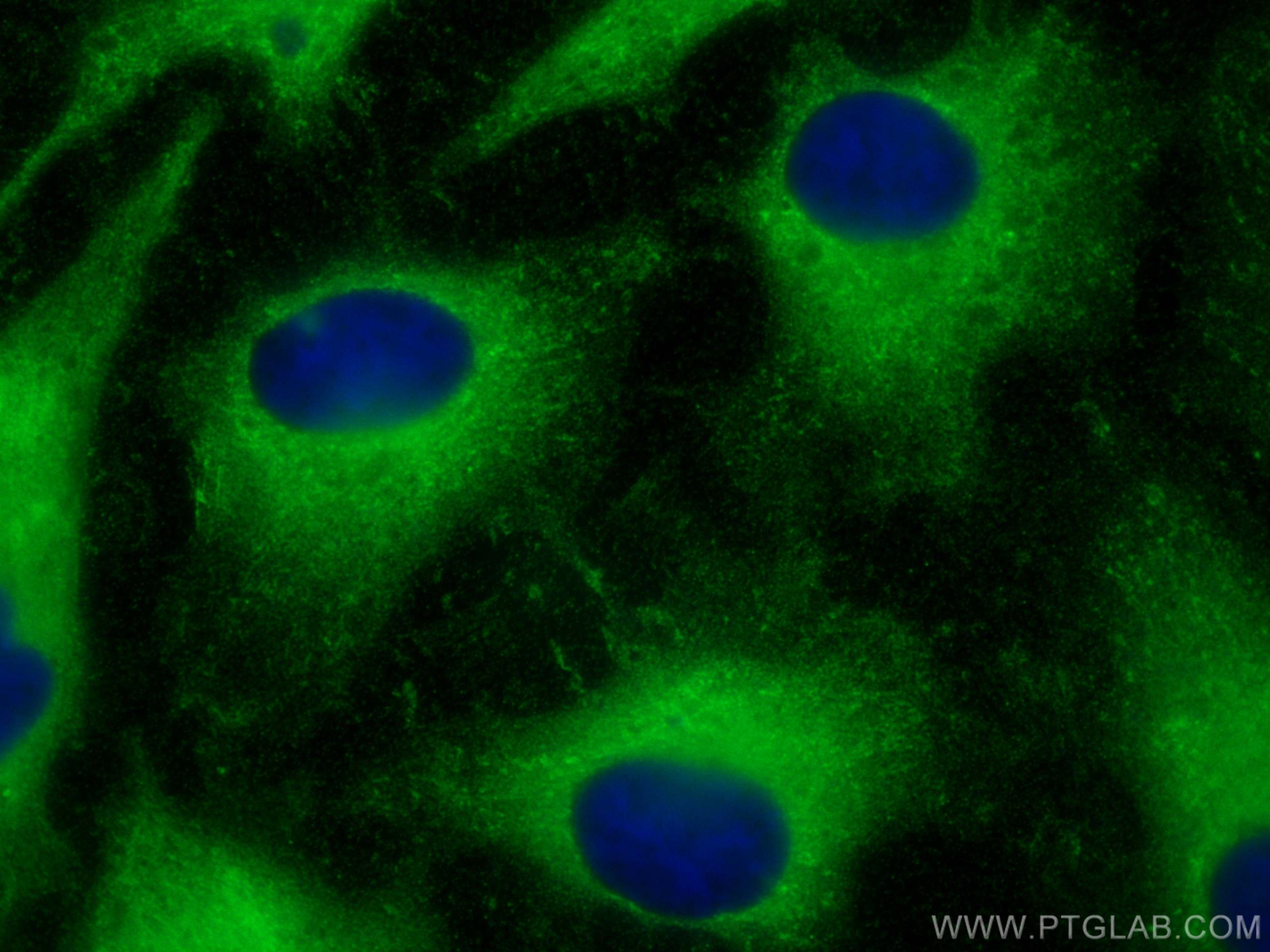 IF Staining of HeLa using 14801-1-AP