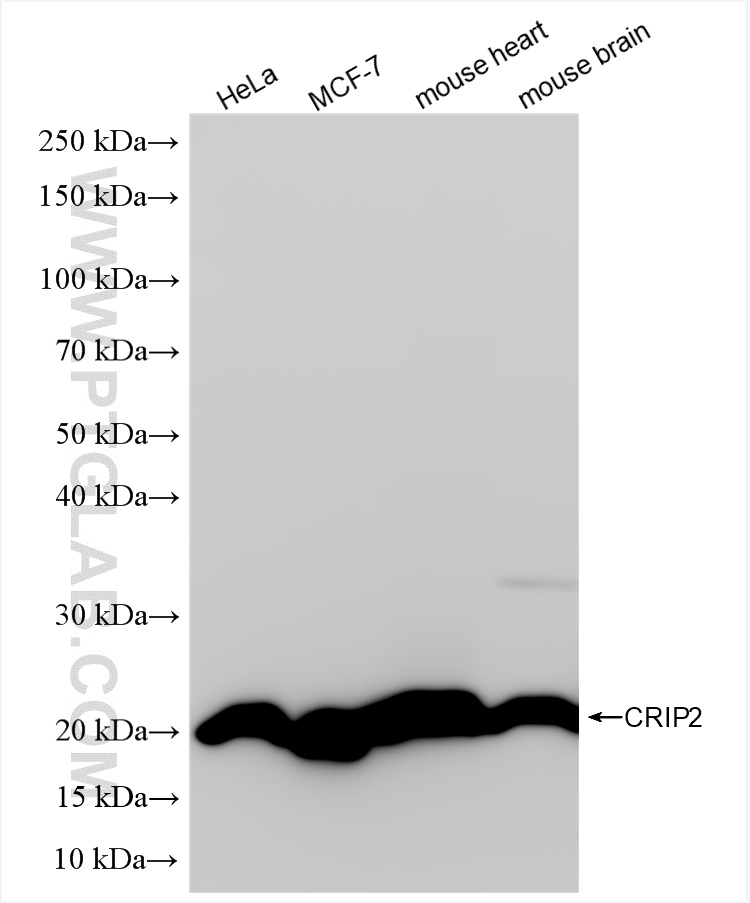 WB analysis using 85826-4-RR
