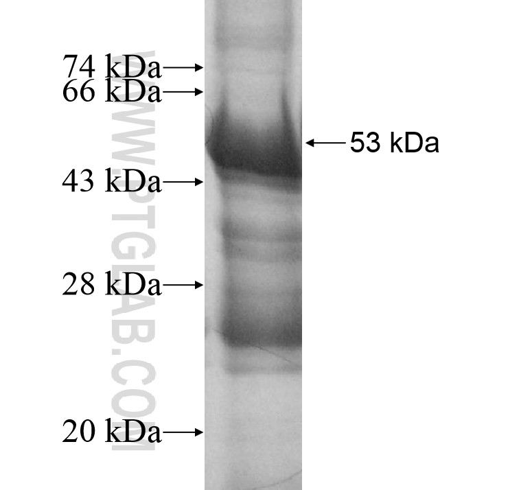 CRISP3 fusion protein Ag12805 SDS-PAGE CRISP3 fusion protein Ag12805 SDS-PAGE