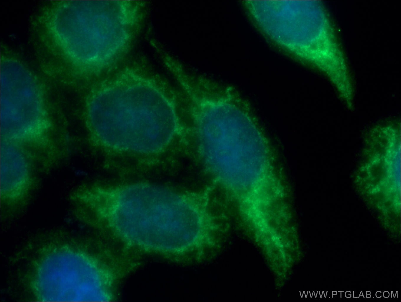 IF Staining of HeLa using 16685-1-AP