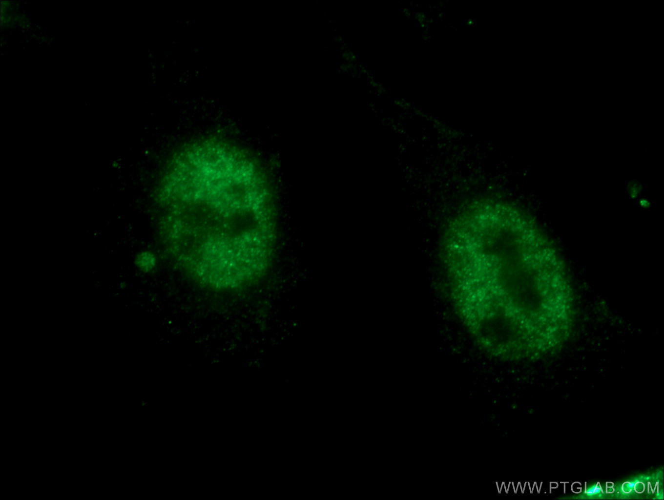 IF Staining of HeLa using 26816-1-AP