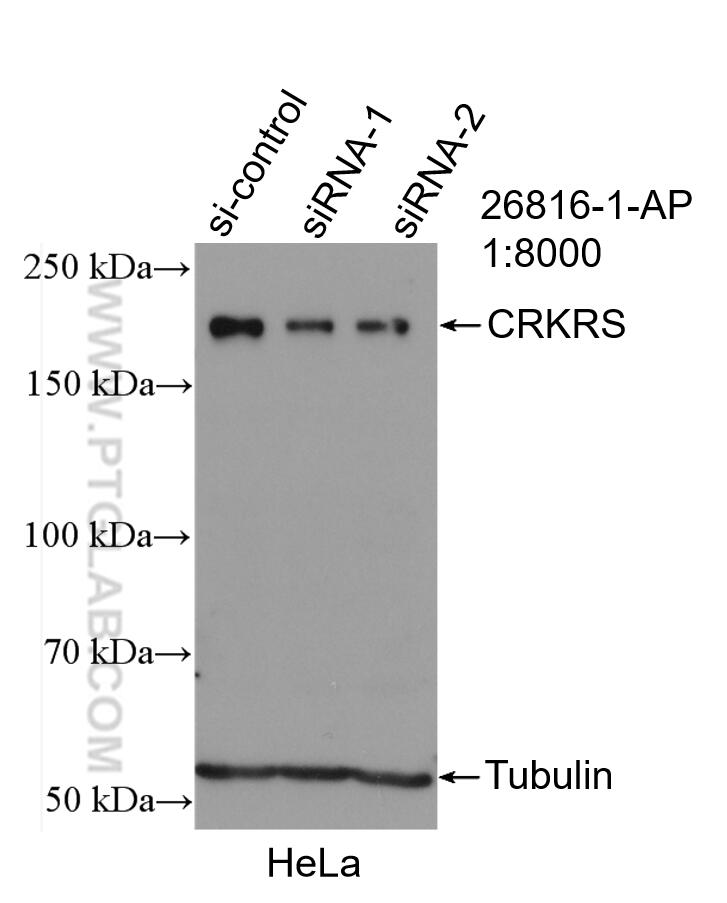 WB analysis of HeLa using 26816-1-AP