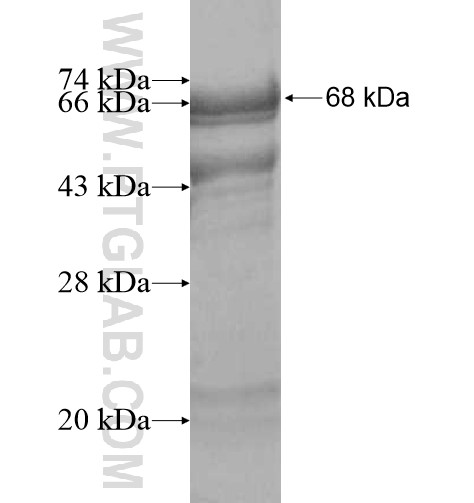 CRLF1 fusion protein Ag10396 SDS-PAGE CRLF1 fusion protein Ag10396 SDS-PAGE